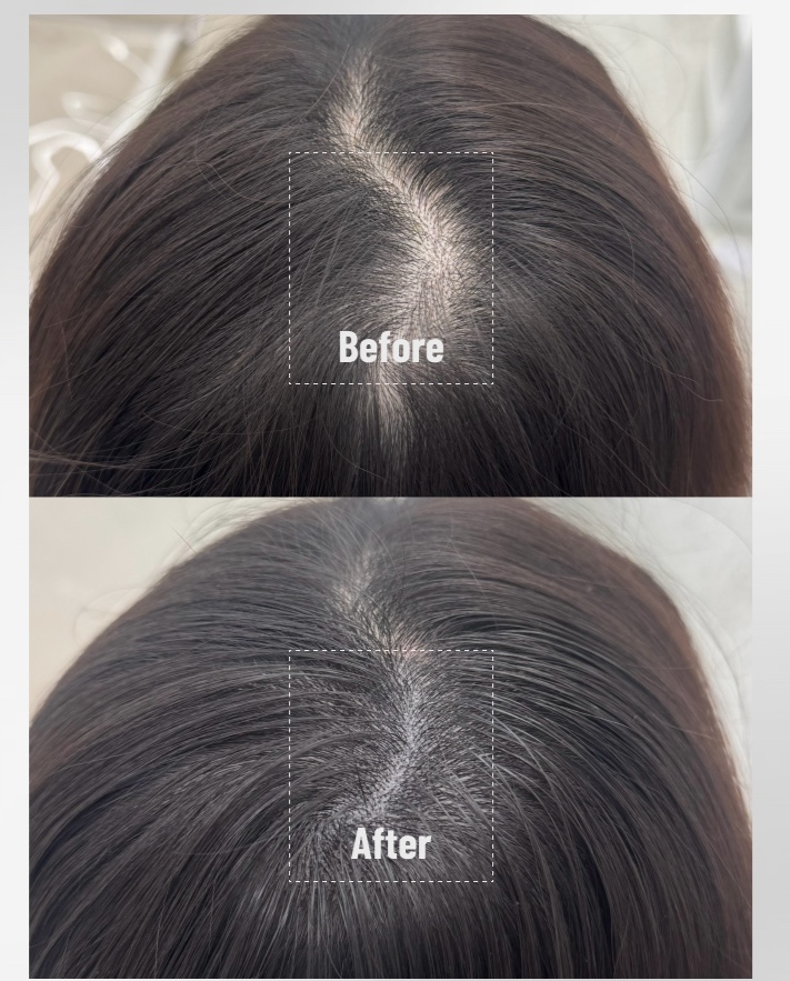 SMP BEFORE & AFTER