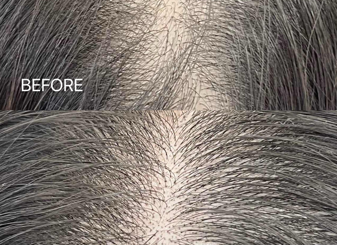 男性SMP BEFORE & AFTER