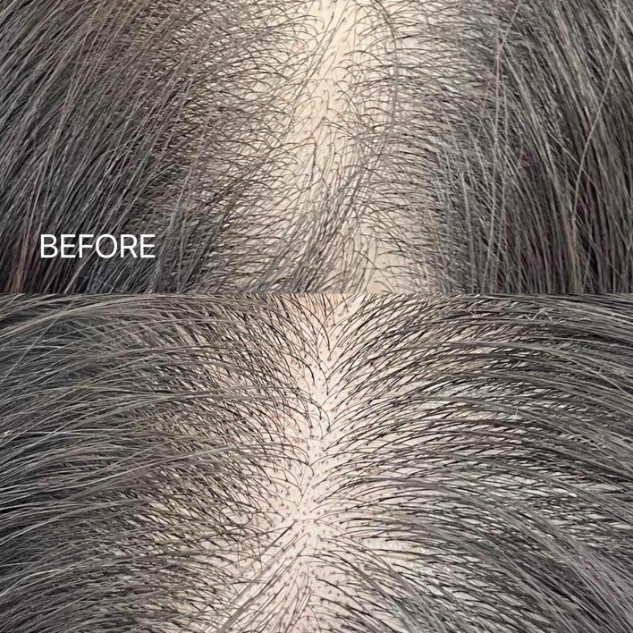 男性SMP BEFORE & AFTER