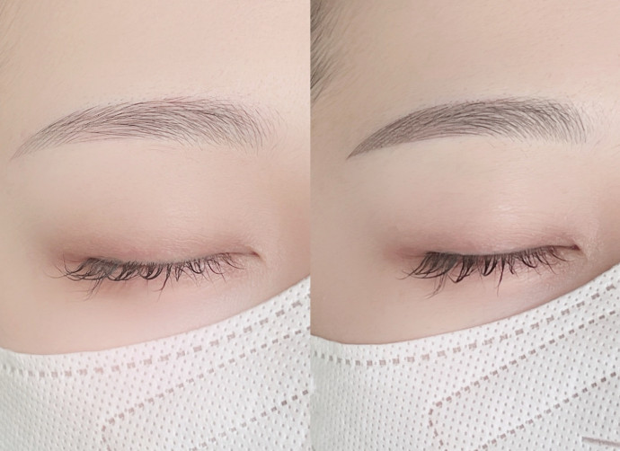 RETOUCH AFTER