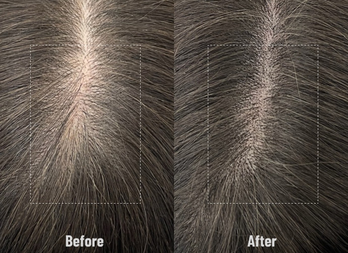 女性SMP BEFORE & AFTER