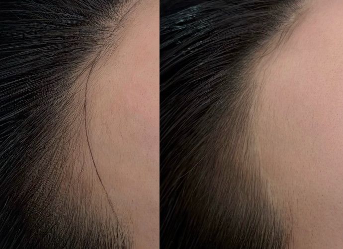 コンボヘアライン