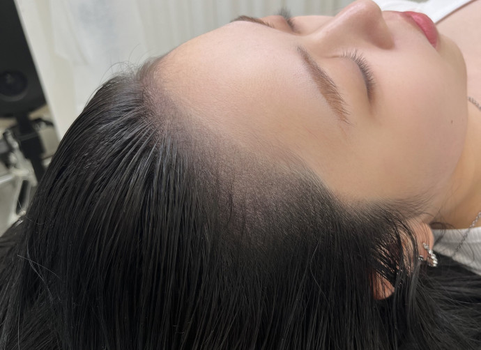 パウダーヘアライン