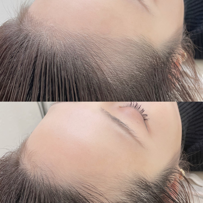 自然ヘアライン