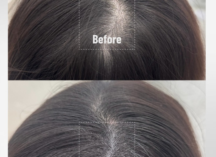 SMP BEFORE & AFTER