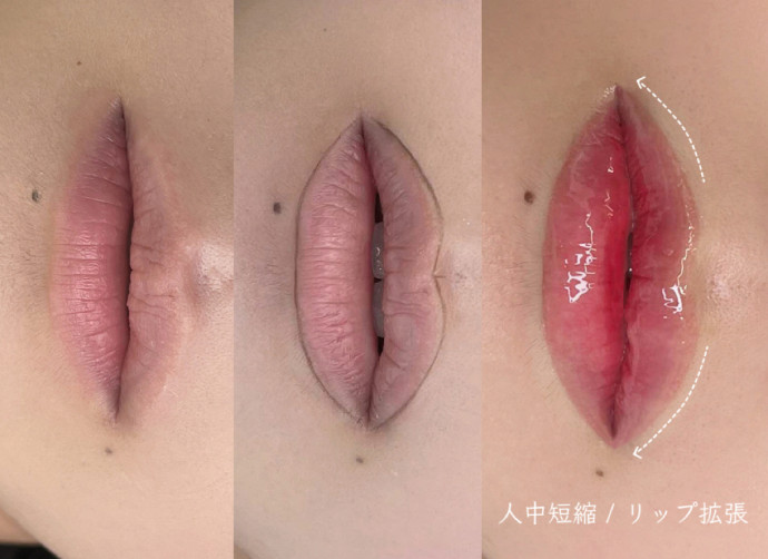 オーバーリップ アートメイク