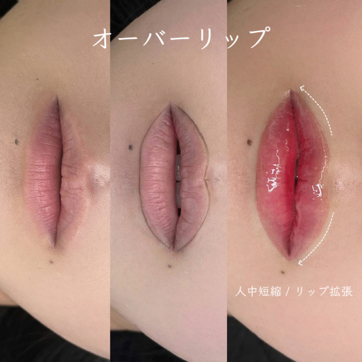 オーバーリップ アートメイク