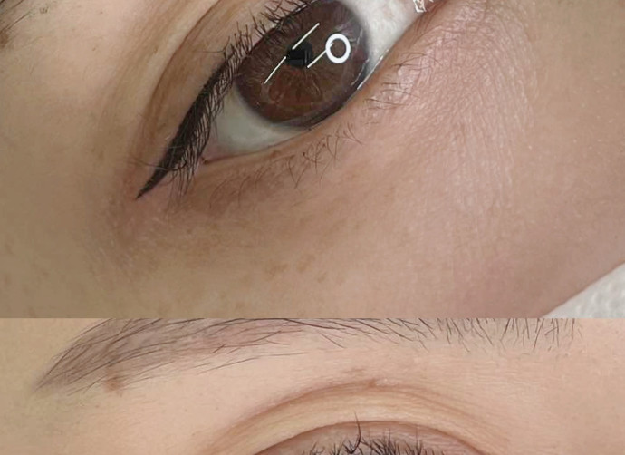 目尻アイライン BEFORE & AFTER