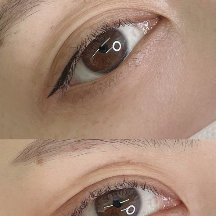 目尻アイライン BEFORE & AFTER