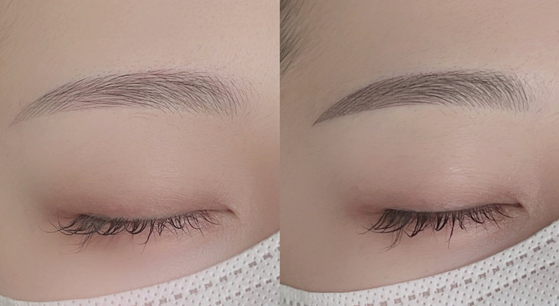 Before and After